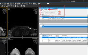 Reviewing a Mammography Hanging Protocol