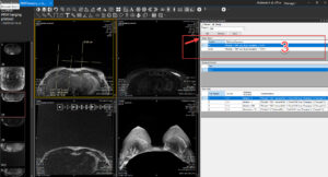 optimizing digital image display 